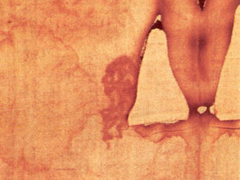 The massive flow of Blood