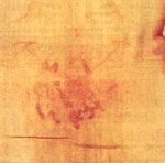 The nape of the neck